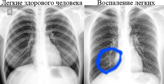 Рентген - доступный метод диагностики